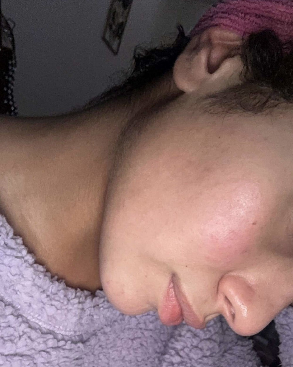 Photo après